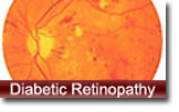Diabetic Retinopathy