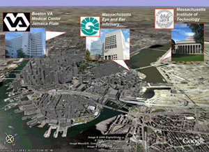The collaborative sites involved in the Boston Retinal Implant Project