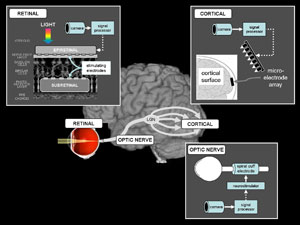 Diagram of the visual system and approaches to restore vision
