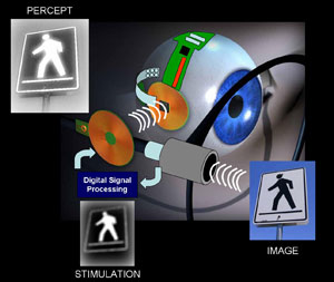 A diagram demonstrating the operation of the visual prosthesis and accompanying camera