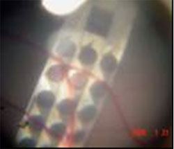 Magnified view of the back of the pig eye showing the surgical placement of an implanted stimulating array. Note the position of the array behind the retinal blood vessels.