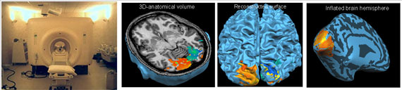 Imagery from functional magnetic resonance imaging at the Boston VA Medical Center