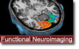 Functional Neuroimaging