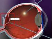 Cross sectional view of the eye
