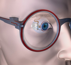 Bionic Eye Smart glasses